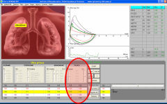 Tgol.e-spirometry screenshot