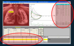 Tgol.e-spirometry screenshot